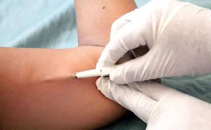 Colocan implantes anticonceptivos gratis