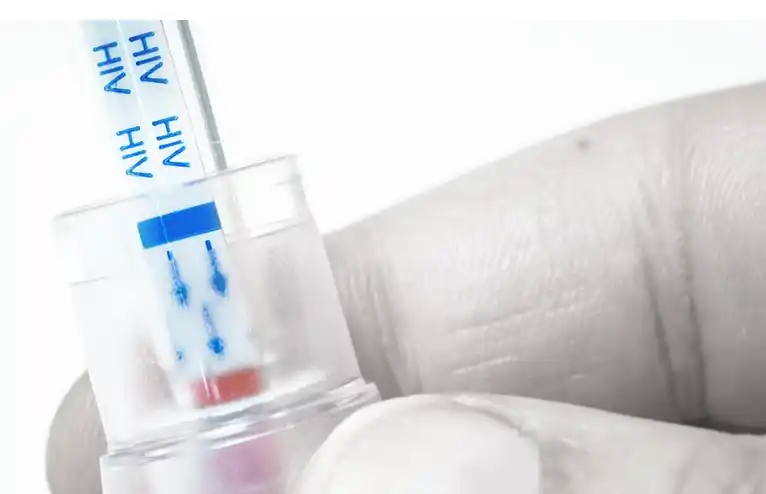 Las personas con VIH que desconocen su condición pasaron del 40% al 13% en 10 años