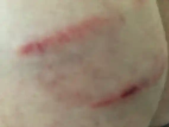 Otro ciudadano fue mordido por un perro