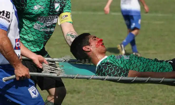 Tremendo codazo lo dejó fuera del partido: debió ser hospitalizado por fisura de tabique