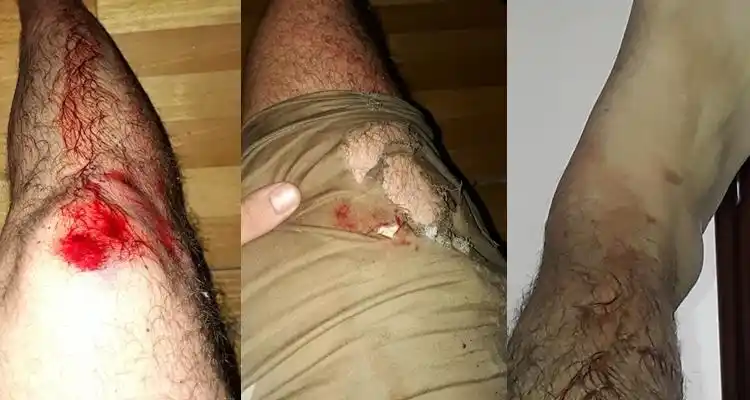 Automovilista chocó y abandonó en la calle a un joven que circulaba en moto