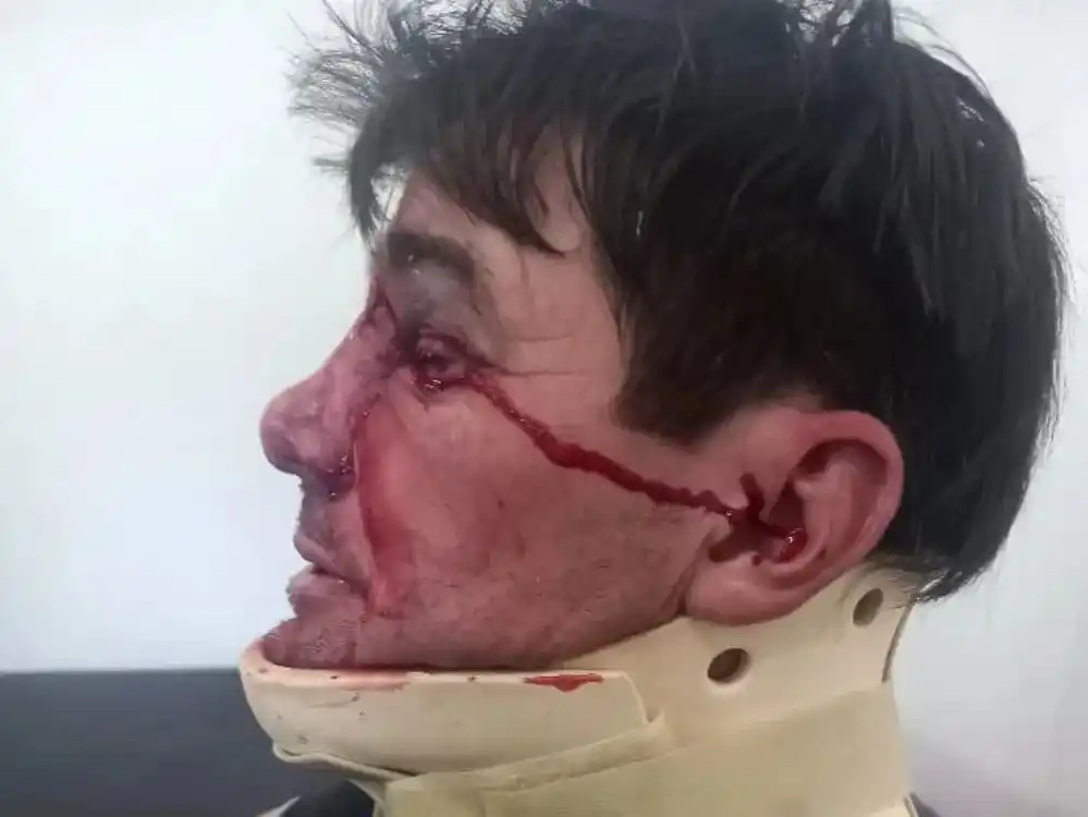 Un ciclista fue agredido por otro en un entrenamiento competitivo de bicicletas de carrera