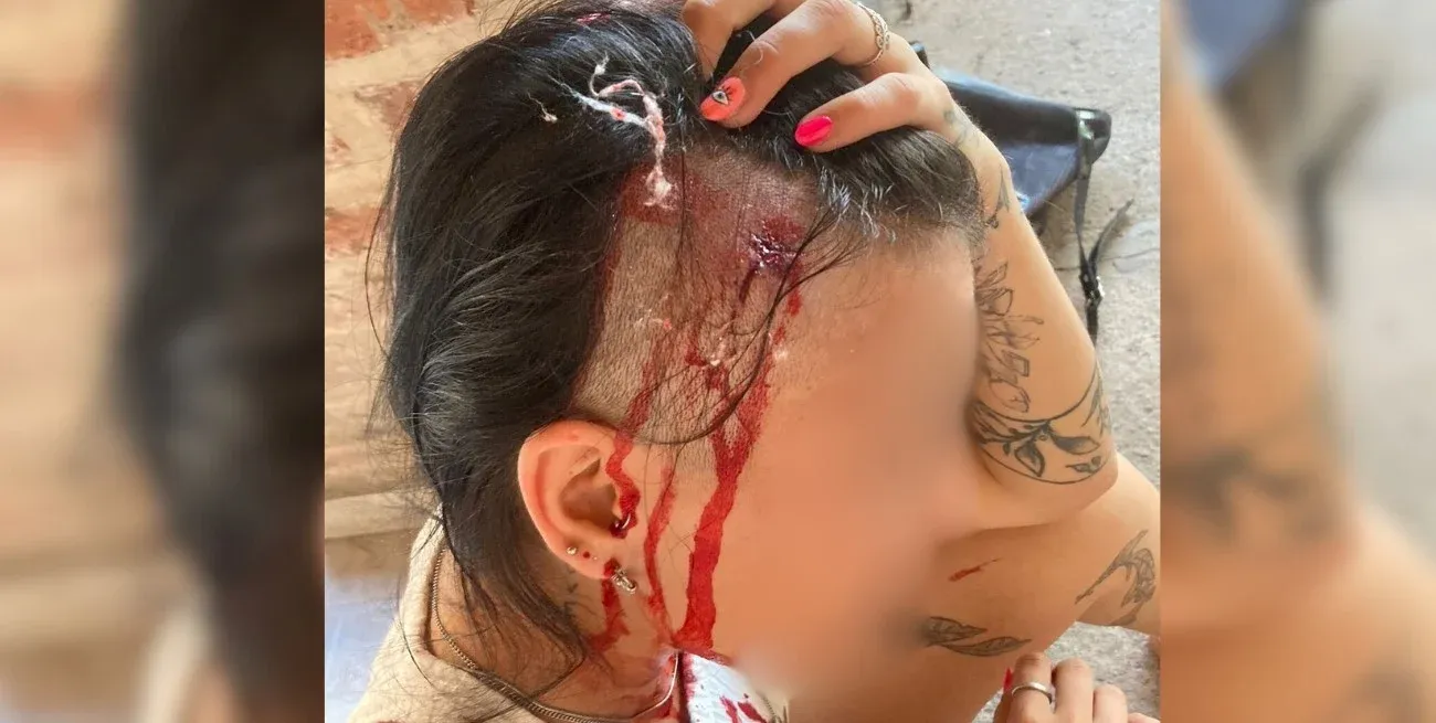 La mujer recibió varios puntos de sutura en su cabeza