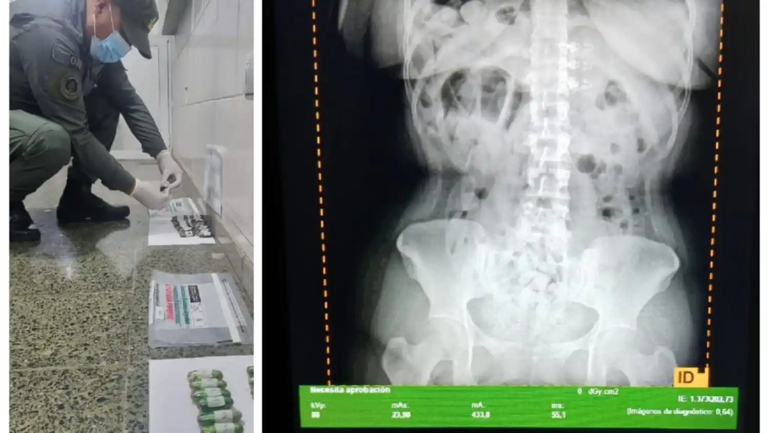 Tucumán: detuvieron a tres “cápsuleras” que transportaban más de dos kilos de cocaína en el cuerpo