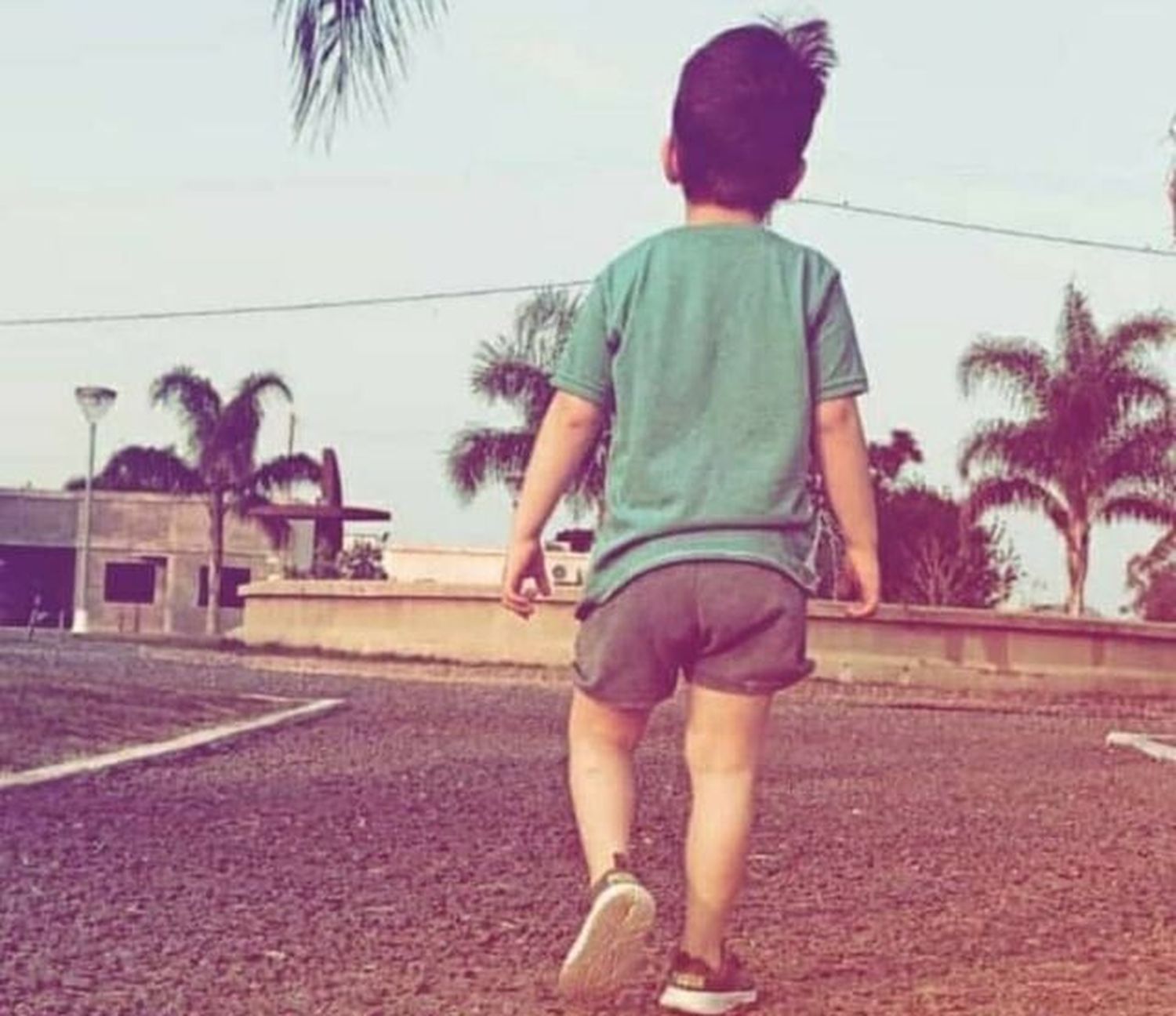 Un niño con hidrocefalia severa fue operado con éxito