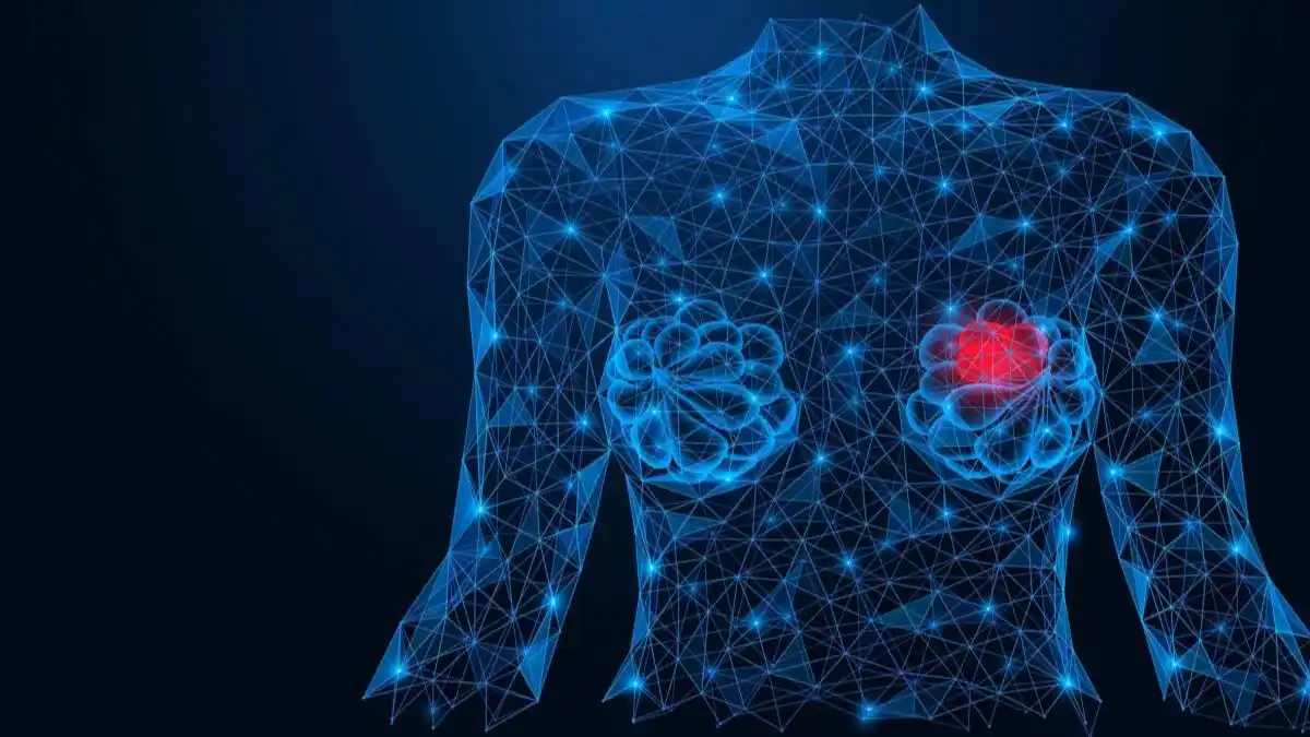 IA revoluciona la detección del cáncer de mama: examinan mamografías con precisión
