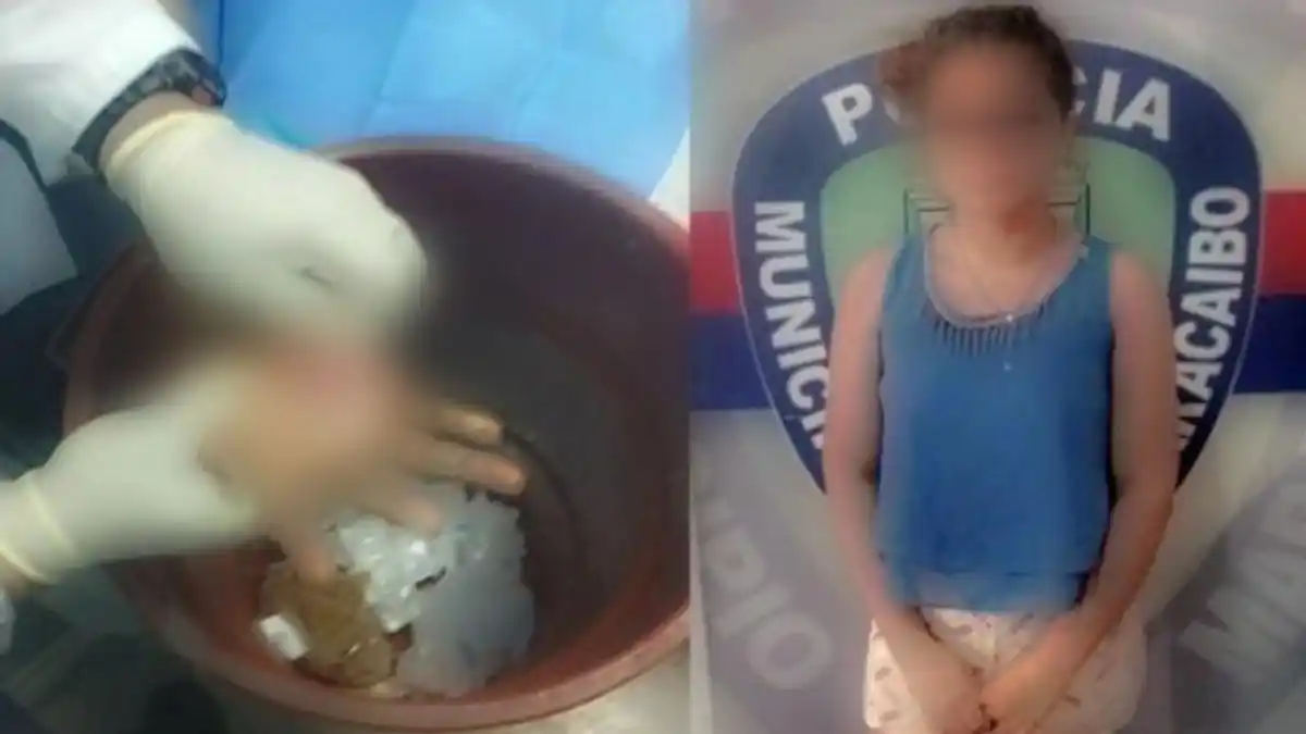 ¡INSÓLITO! Quemó las manos a su hermanita a porque agarró $15 para comprar comida