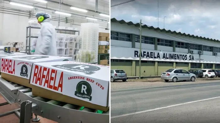 calculos billiares detenido casilda - 1