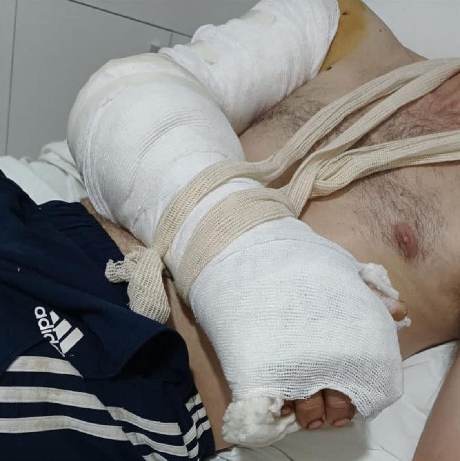 Gonzalo Sartor, herido de un tiro en un brazo.