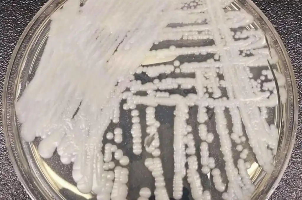 Alerta: en EE.UU. se propaga una superbacteria que no posee tratamiento