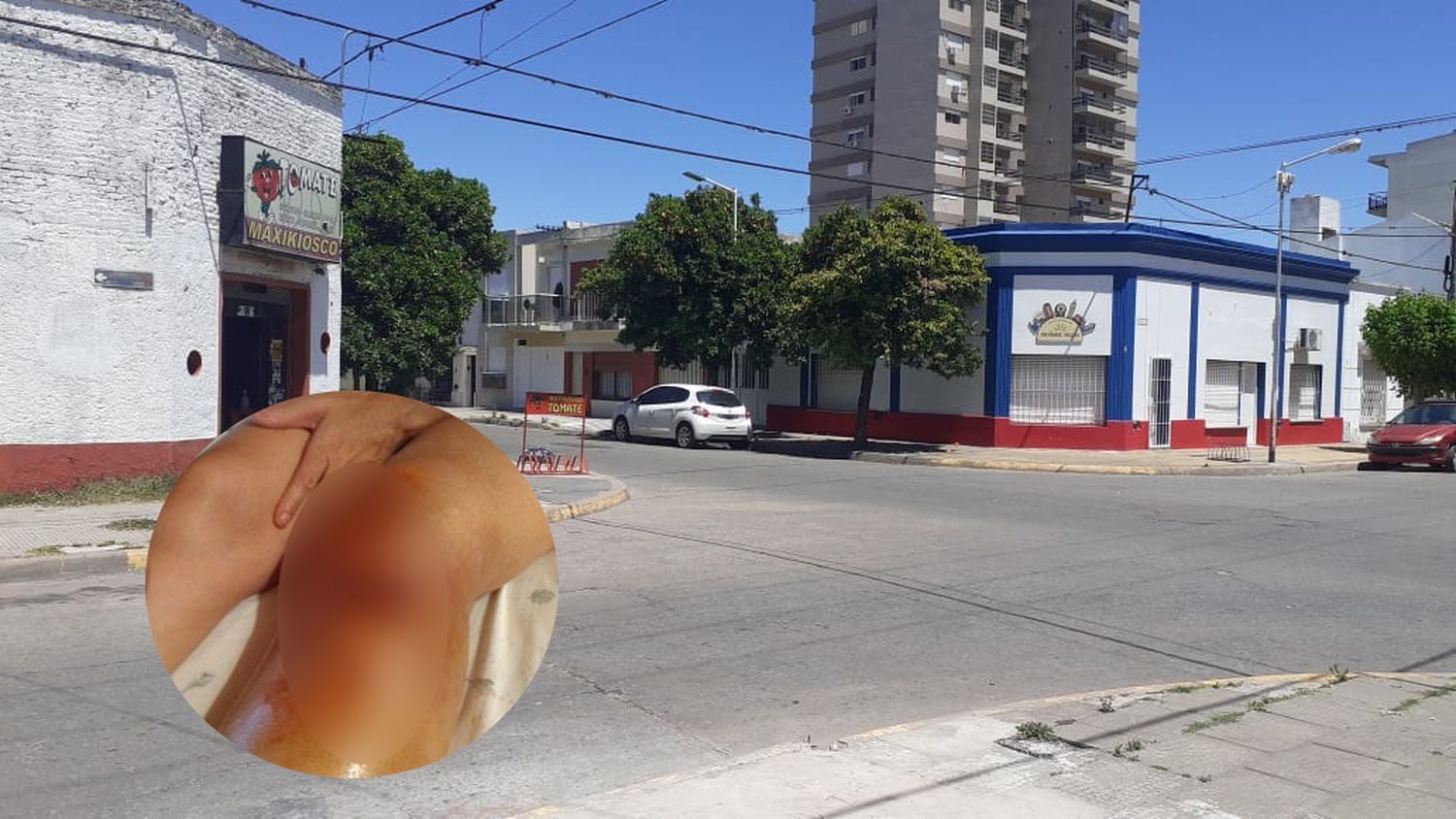 Operaron a la ciclista que perros callejeros hicieron caer en Rivadavia y Obligado: “No se sabe cómo quedará”, dijo su esposo