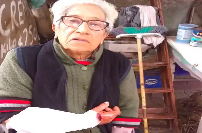 Nuevo ataque de perros en Mar del Plata: mordieron a una mujer de 84 años