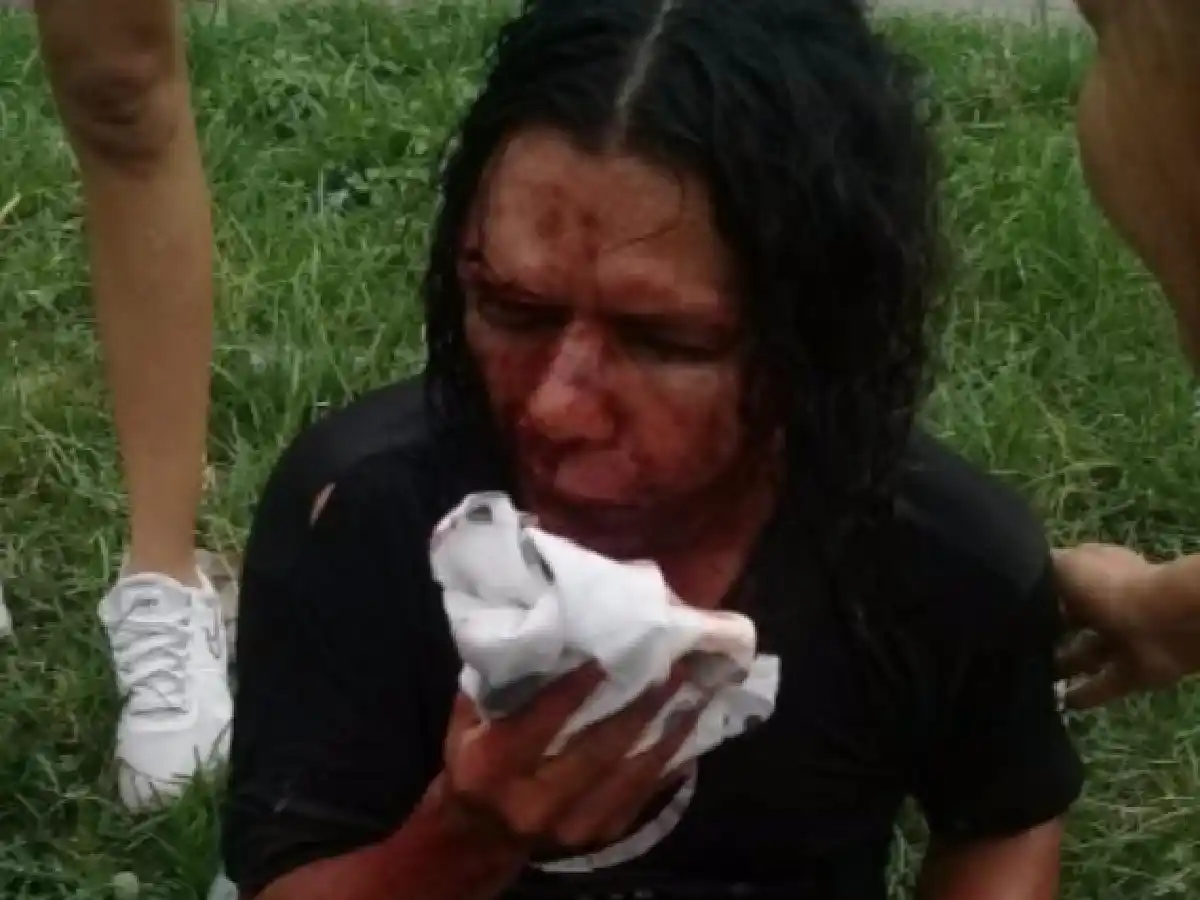 Tucumán: fue atacado por su condición sexual y está en terapia