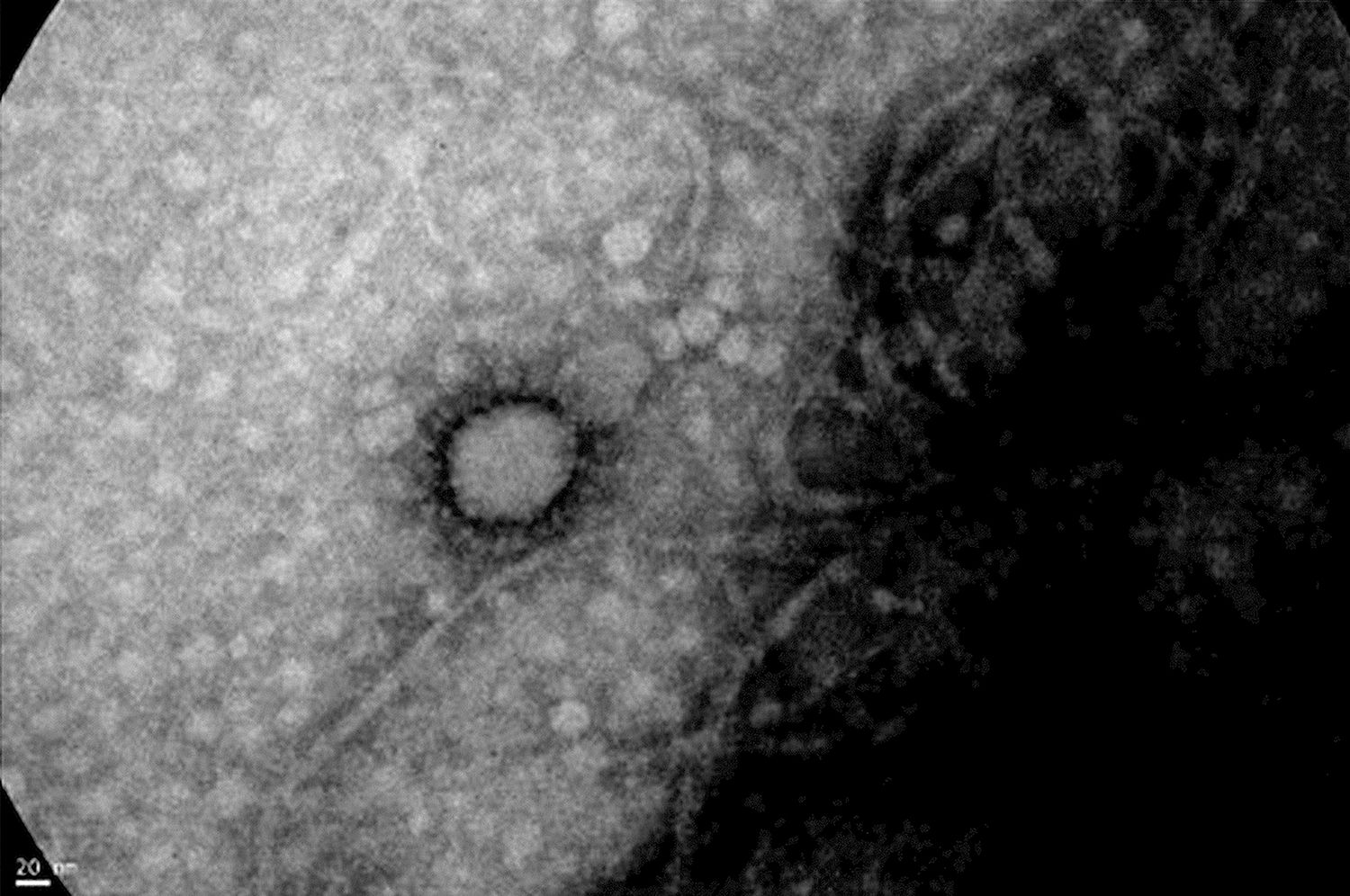 El ANLIS – Malbrán captó la primera foto del nuevo coronavirus que circula en Argentina