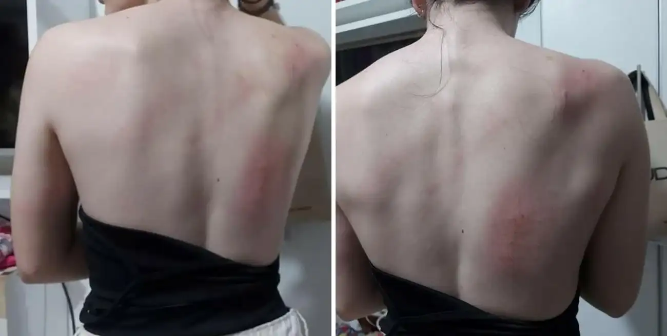 La menor resultó con lesiones por raspaduras en la espalda y piernas.