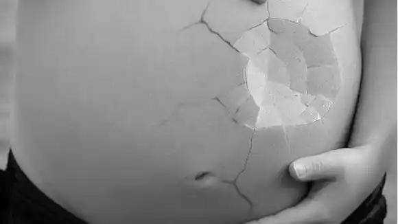 Mujer muere tras hacerse aborto clandestino con «popular» médico de Barranquilla