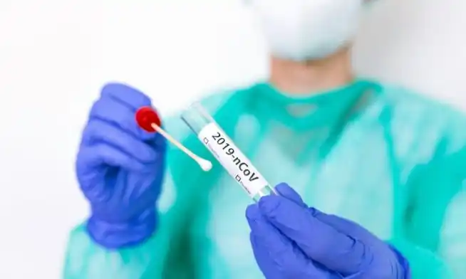 Coronavirus: más de 20.000 contagios y otros 387 muertos en las últimas 24 horas