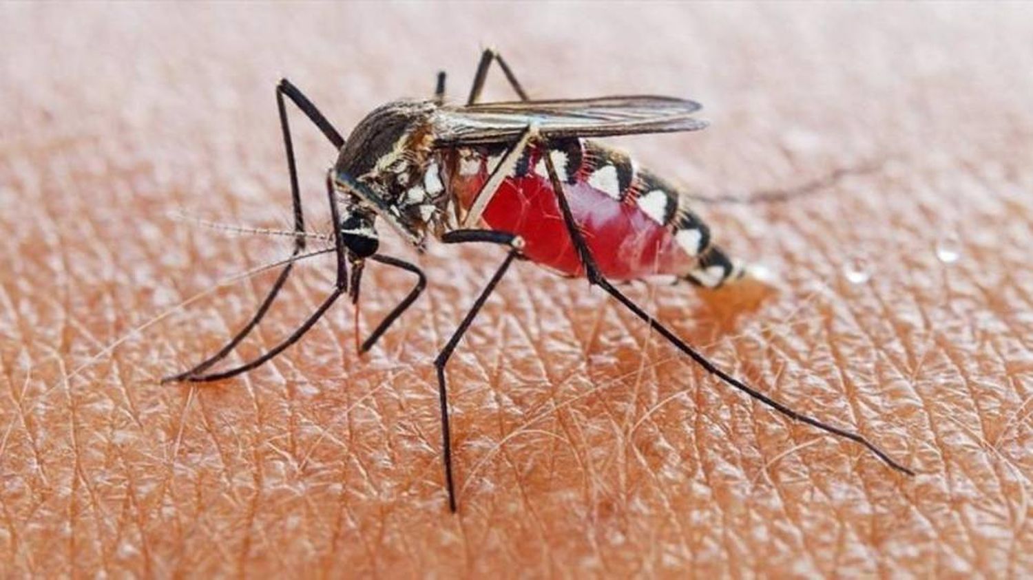 ¡ES UN REFUGIADO! Paraguay confirma un caso de malaria proveniente de Venezuela