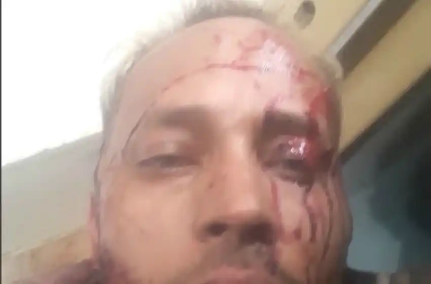 Venezuela: murió el opositor Oscar Pérez