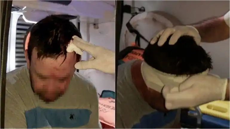 Concepción del Uruguay: lo atropellaron dos jinetes a caballo y lo abandonaron herido