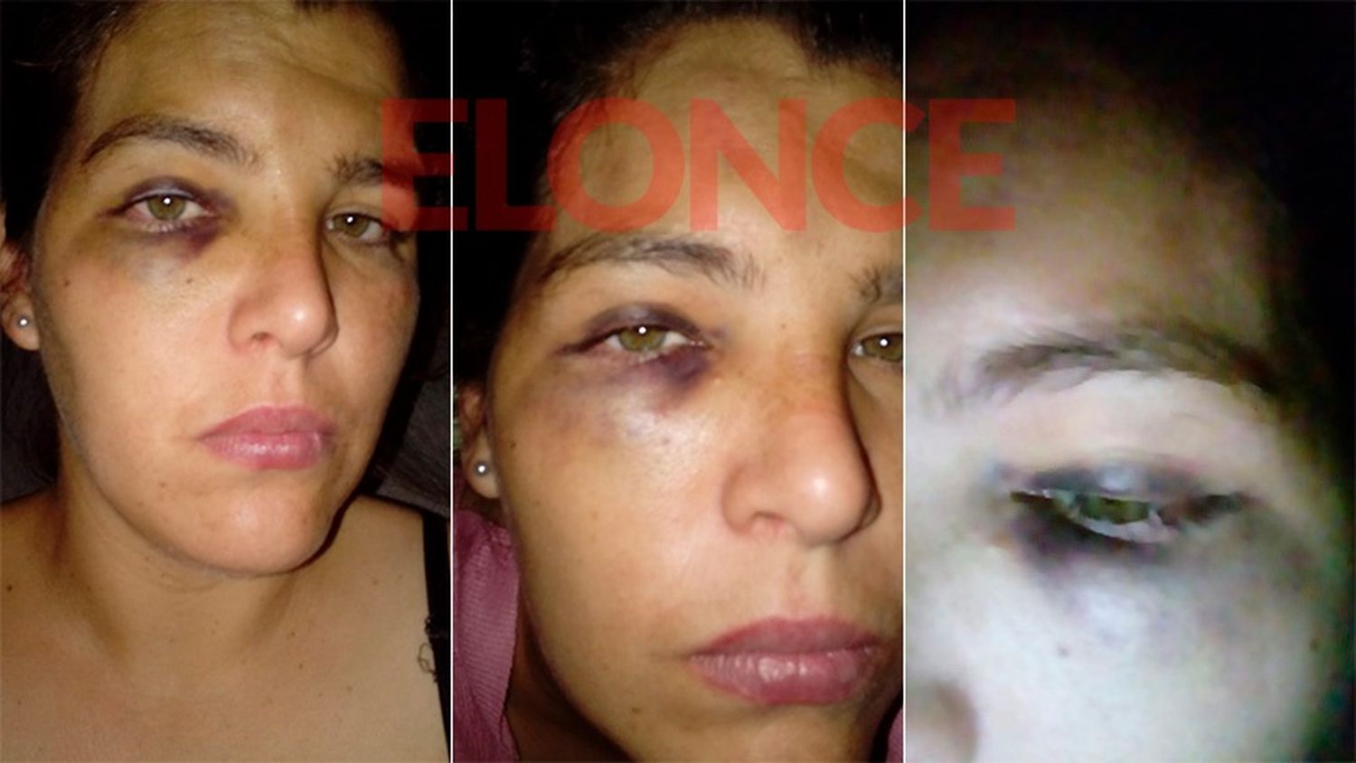 Perdió un bebé por una golpiza: "Cuando me mate, qué van a decirle a mis hijas"