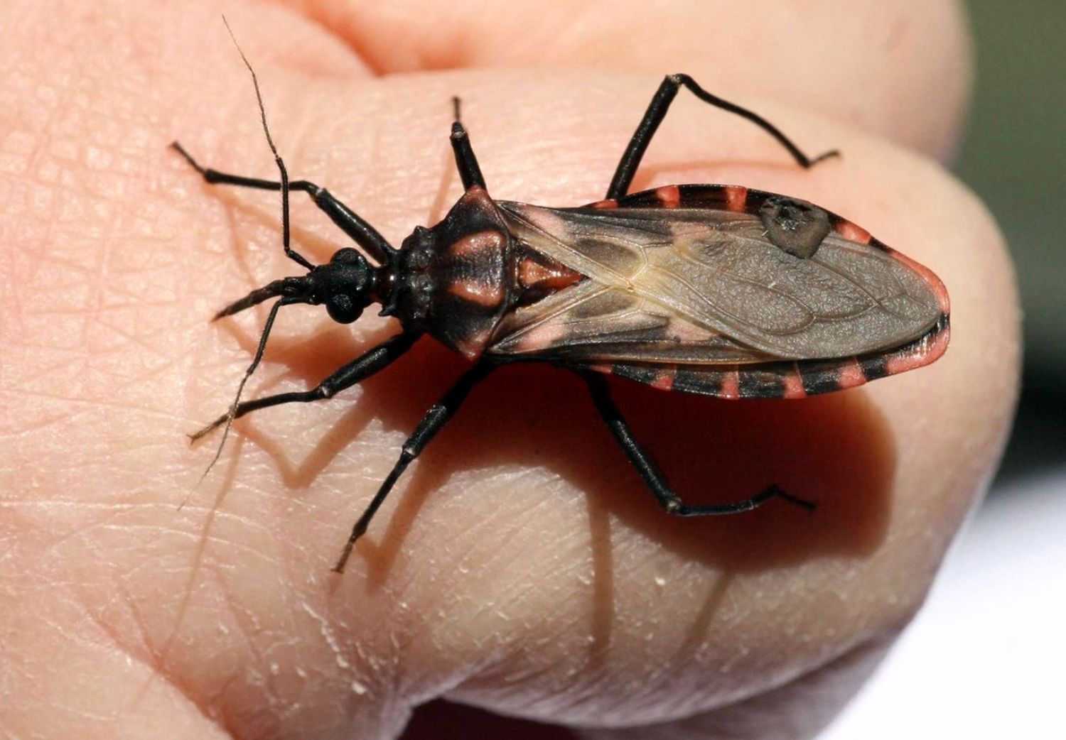 La importancia de detectar el Chagas