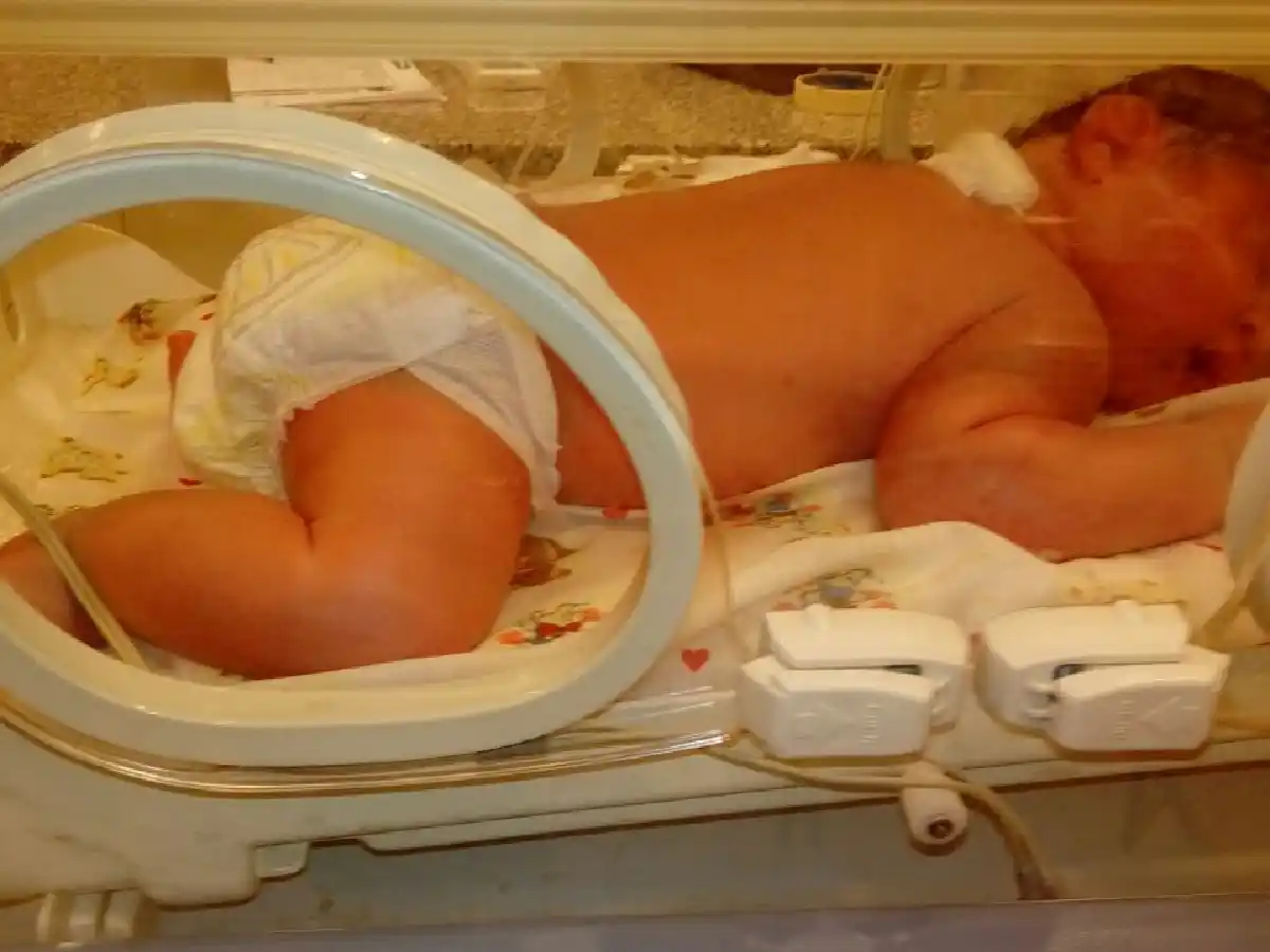 Pequeño y gran bebé: Benjamín el niño que nació con más de 5 kilos