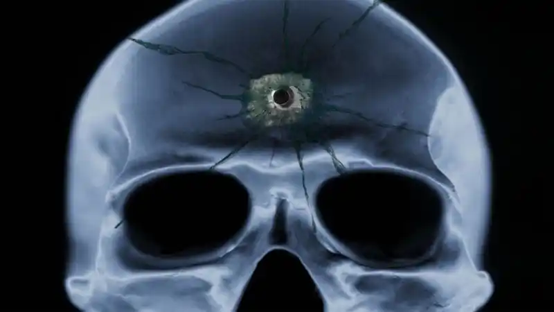 Caminó hasta el hospital con un disparo en la cabeza