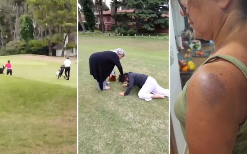 “Me partió el palo en la cabeza, loca de mierda”, relató
