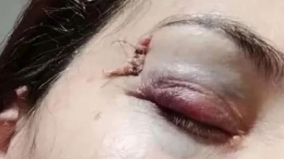 Lo retaron por jugar a las cartas en plena clase, le pegó a la maestra y la mandó al hospital: Pasó en General Villegas