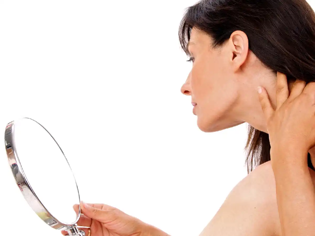 En la piel se pueden reflejar síntomas de resistencia a la insulina, diabetes y celiaquía