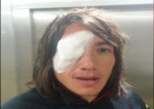 Primer incidente tras el retorno de los hinchas visitantes: Le pegaron un piedrazo a Lugüercio