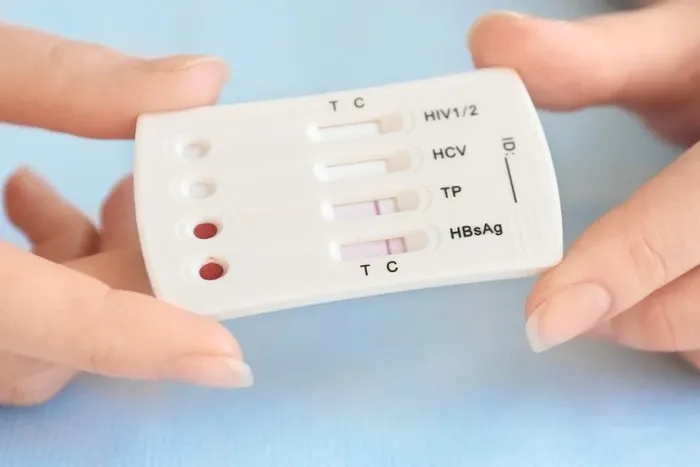 Fuerte incremento de la sífilis en la población general