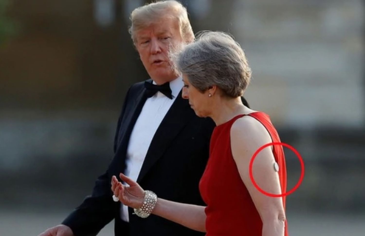Qué es el dispositivo blanco que lleva Theresa May en el brazo