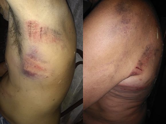 El hombre mayor apaleado por un vecino se recupera y su familia pide restricción perimetral