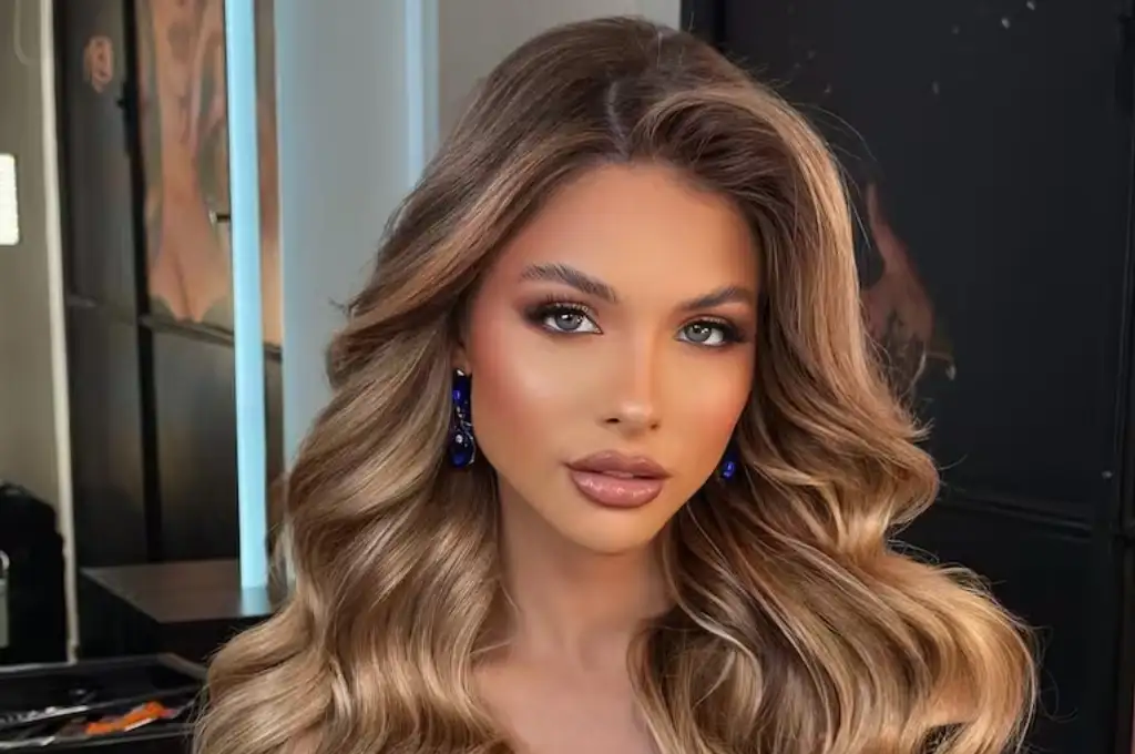 La Miss Universo Argentina, confesó la condición que padece desde que nació. Imagen ilustrativa. (Foto: Gentilezas)