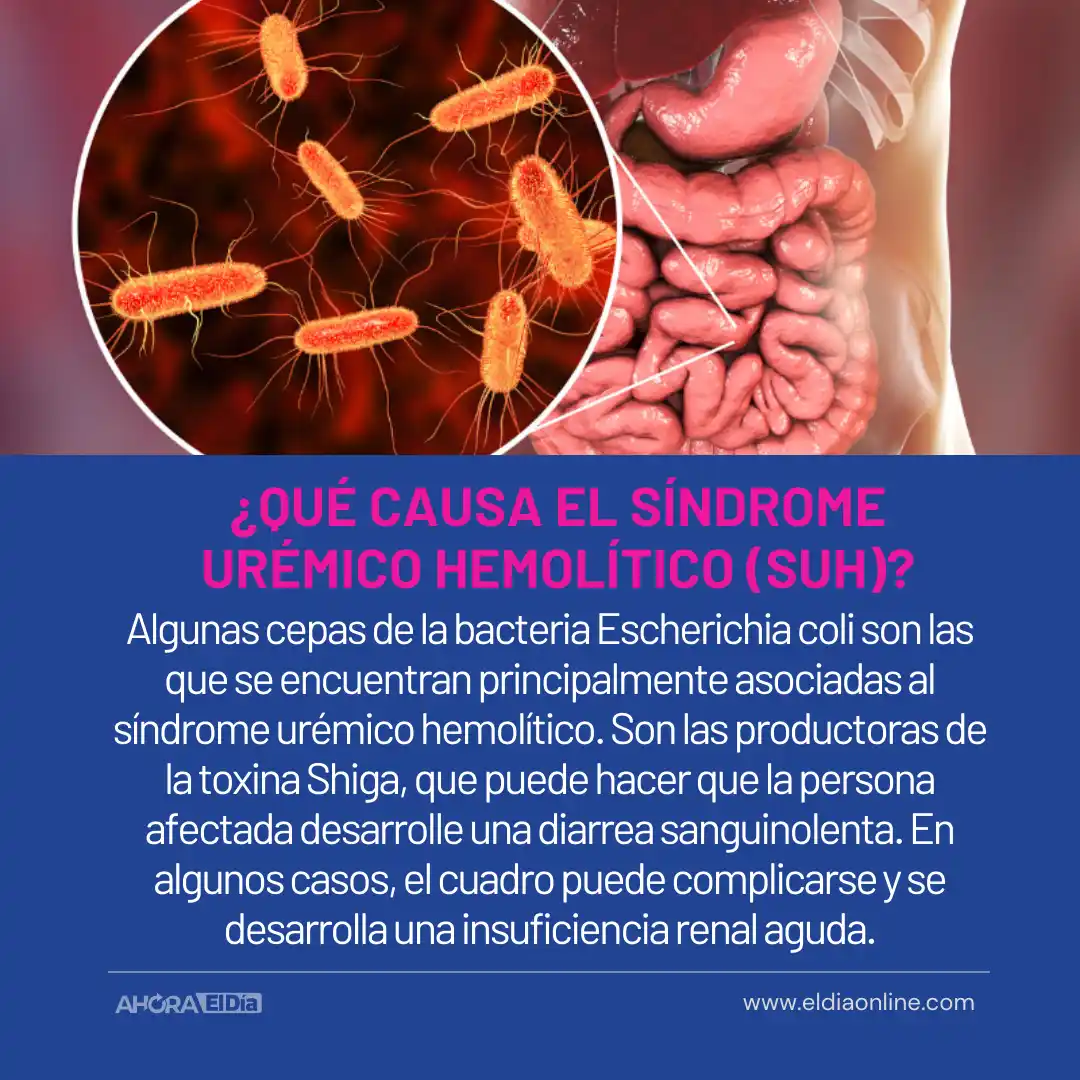 Síndrome Urémico Hemolítico: Cómo prevenir la enfermedad de la “Carne Cruda” - 4