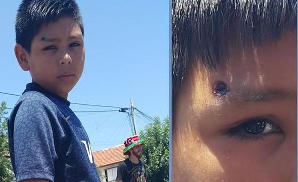 Diputados bonaerenses del FpV repudiaron la represión a niños de una murga en Bajo Flores