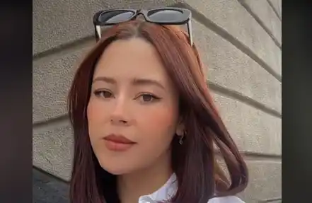 Cirugía estética fallida: se realizó una bichectomía y terminó con la cara desfigurada