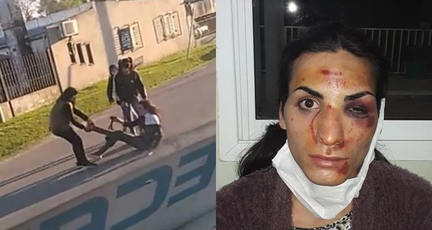 La joven trans que recibió una golpiza tras participar de dos reuniones sociales contó como la atacaron y aseguró que nadie la ayudó
