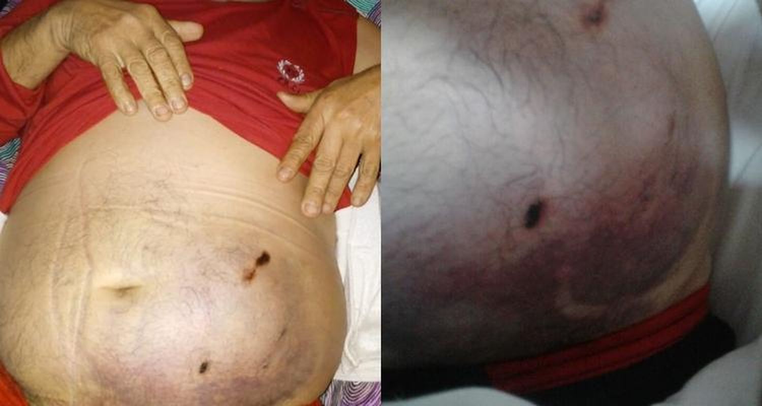 Un jubilado fue internado tras ser herido en su abdomen por dos perros