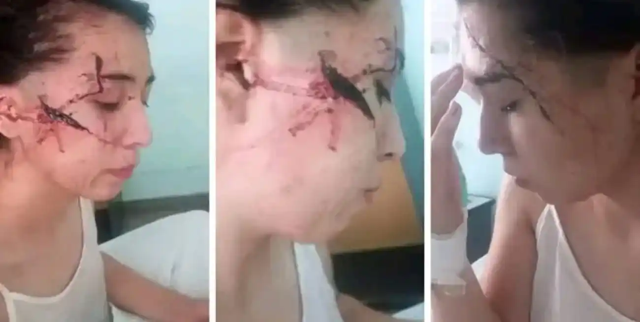 La adolescente fue sometida a una cirugía reconstructiva.