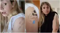 Una mujer asegura que quedó imantada tras recibir la vacuna de AstraZeneca: sus fotos y qué dicen los especialistas