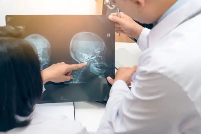 Cánceres de cabeza y cuello: la importancia de una pronta detección