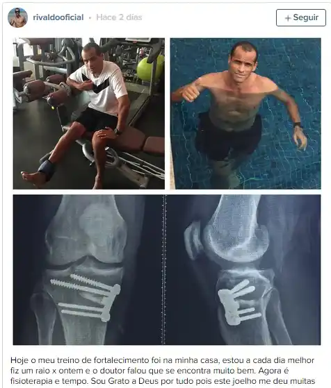  Así quedó la rodilla de un crack del fútbol mundial 