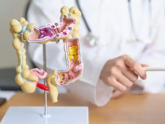 “El cáncer colorrectal es la segunda causa de muerte por cáncer en Argentina”