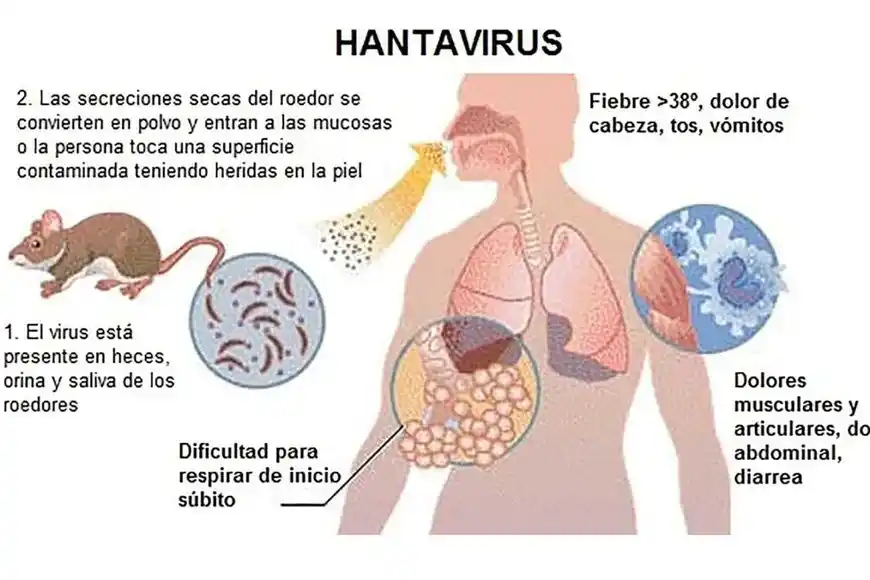 Hantavirus: ¿qué es, cómo se contagia y cómo se previene?
