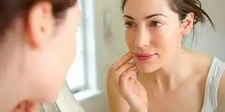 Cómo mantener la rosacea bajo control