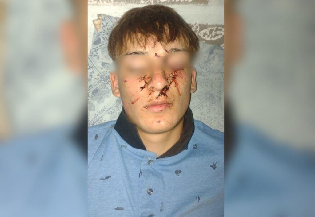 Violencia en la noche del viernes: menor golpeado en un pub de Claromecó