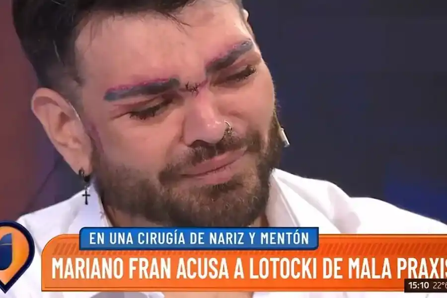 El dolor de Fran Mariano en medio de su denuncia: "Me desfiguró"